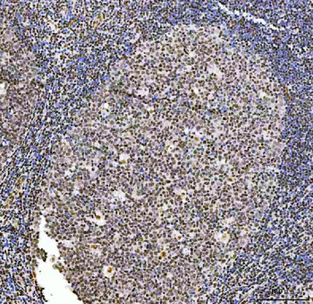 Anti-Exonuclease 1/EXO1 Antibody