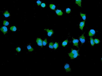 Anti-Filamin A/FLNA Antibody