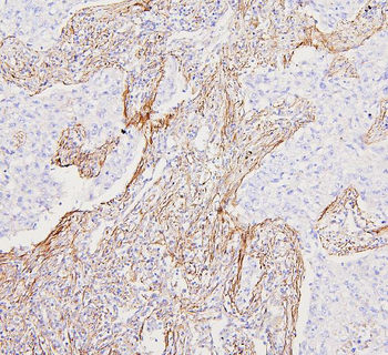 Anti-Filamin A/FLNA Antibody