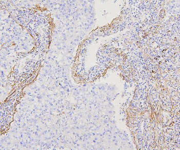 Anti-Filamin A/FLNA Antibody