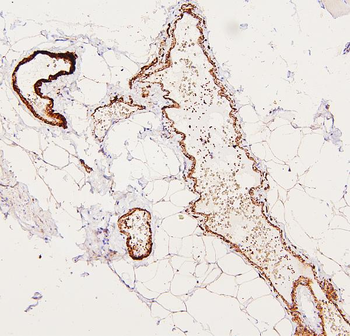 Anti-Filamin A/FLNA Antibody