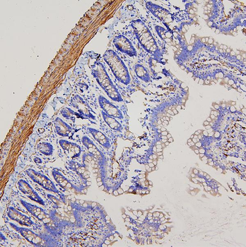 Anti-Filamin A/FLNA Antibody