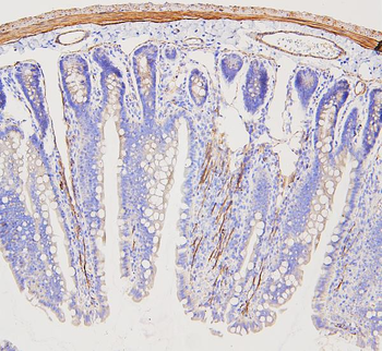 Anti-Filamin A/FLNA Antibody