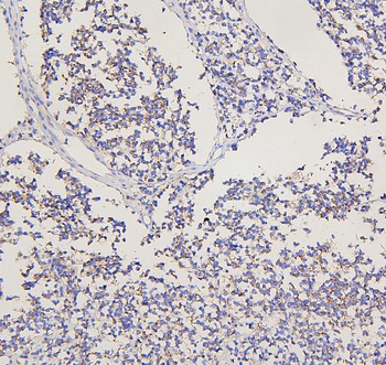 Anti-Metabotropic glutamate receptor 2/GRM2 Antibody
