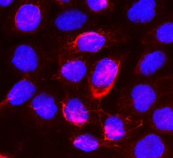 Anti-beta glucuronidase/GUSB Antibody