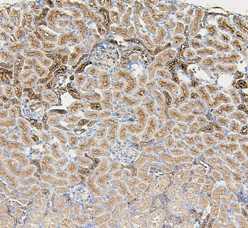 Anti-beta glucuronidase/Gusb Antibody