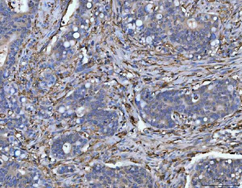 Anti-HLA-DR/HLA-DRA Antibody