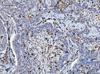 Anti-HLA-DR/HLA-DRA Antibody