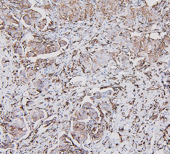 Anti-HLA-DR/HLA-DRA Antibody