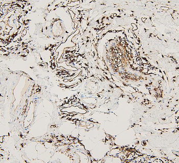 Anti-HLA-DR/HLA-DRA Antibody