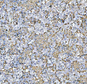 Anti-HLA-DR/HLA-DRA Antibody
