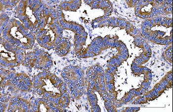 Anti-IQGAP1 Antibody