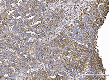 Anti-IQGAP1 Antibody