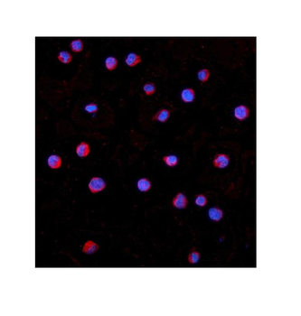 Anti-IRAK-1/IRAK1 Antibody