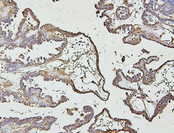 Anti-IRAK-1/IRAK1 Antibody