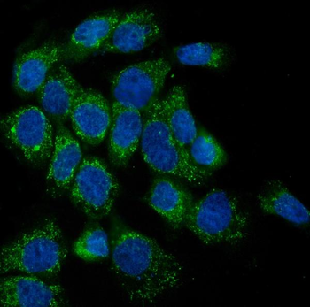 Anti-Lipoma-preferred partner LPP Antibody