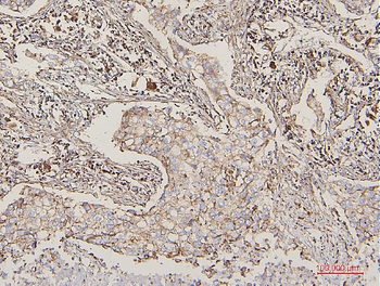 Anti-Lipoma-preferred partner LPP Antibody