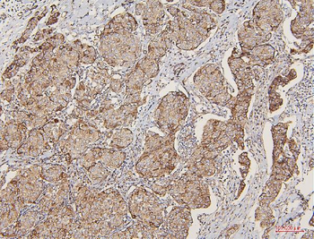 Anti-Lipoma-preferred partner LPP Antibody