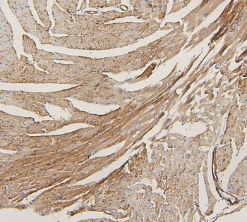 Anti-Lipoma-preferred partner LPP Antibody