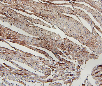 Anti-Lipoma-preferred partner LPP Antibody