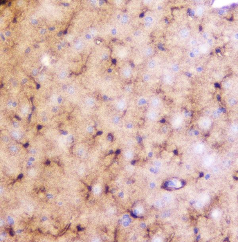 LRTOMT Antibody
