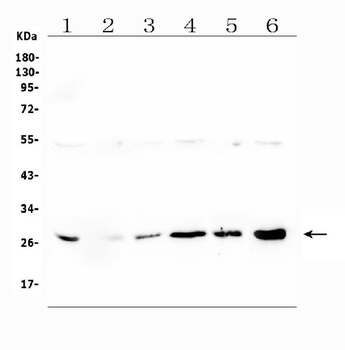 LRTOMT Antibody