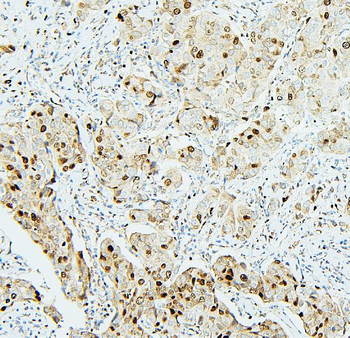 Anti-MCM2 Antibody