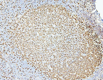 Anti-MCM2 Antibody