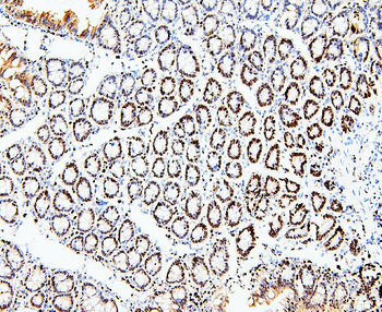 Anti-MCM2 Antibody