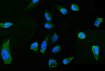 Anti-Moesin/MSN Antibody