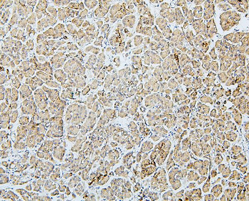 Anti-MTR Antibody