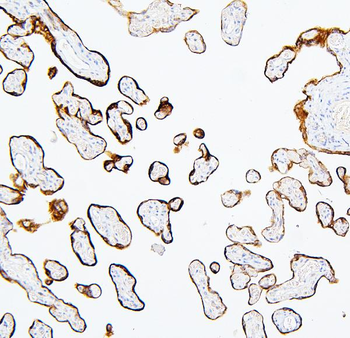 Anti-MTR Antibody