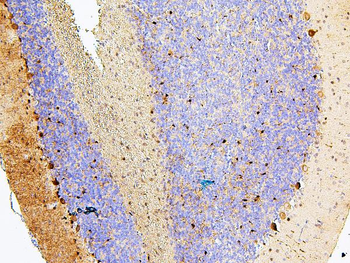 Anti-MTR Antibody