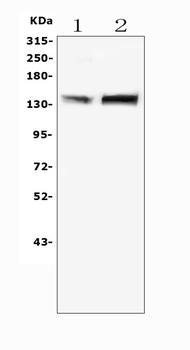Anti-MTR Antibody