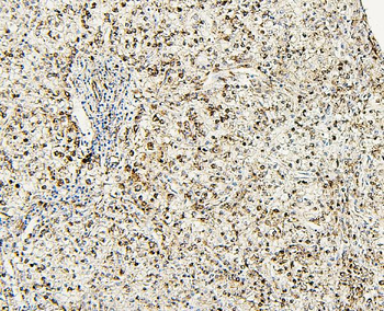 Anti-PXR/NR1I2 Antibody