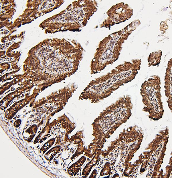 Anti-PXR/NR1I2 Antibody