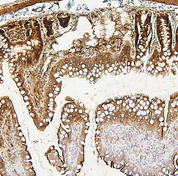 Anti-PXR/NR1I2 Antibody