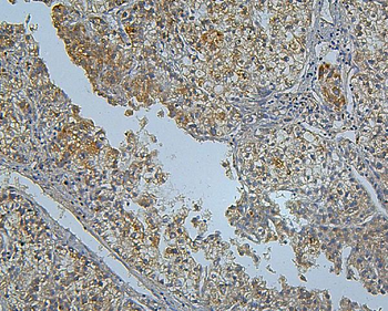 PCSK9 Antibody