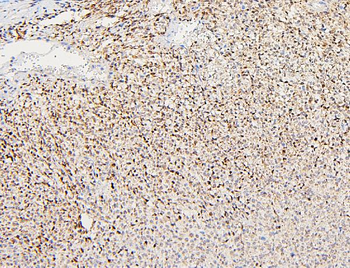 Anti-Polycystin 2/PKD2 Antibody