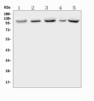 Anti-Polycystin 2/PKD2 Antibody