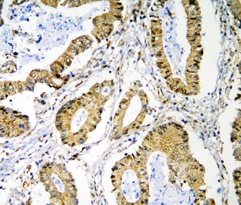 PRMT1 Antibody