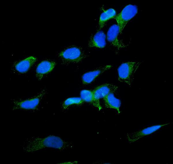 Radixin/RDX Antibody