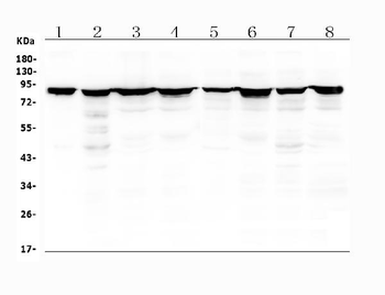 Radixin/RDX Antibody