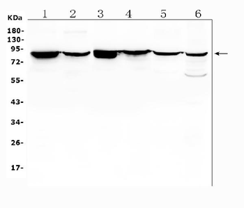 Radixin/RDX Antibody