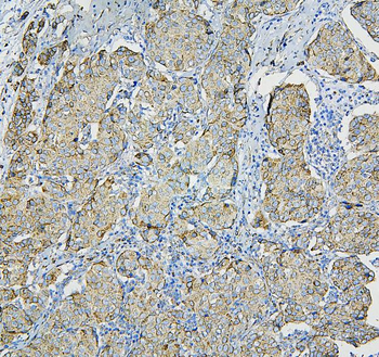 RPL13A Antibody