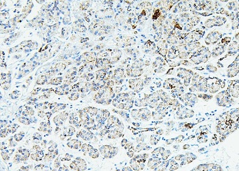 RPL13A Antibody
