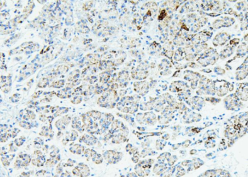 Anti-RPL13A Antibody