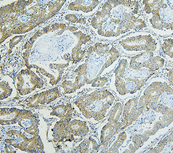 Anti-RPL13A Antibody