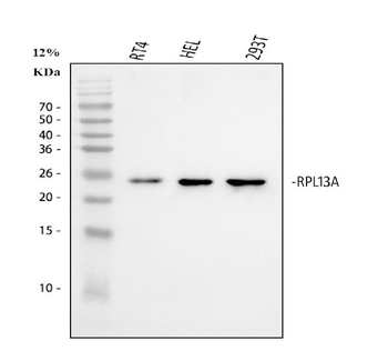 Anti-RPL13A Antibody