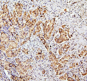 Anti-SUZ12 Antibody